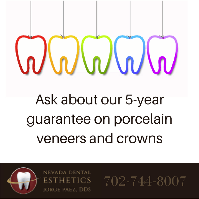 5 year guarantee on veneers and crowns 626a8541ea6e2
