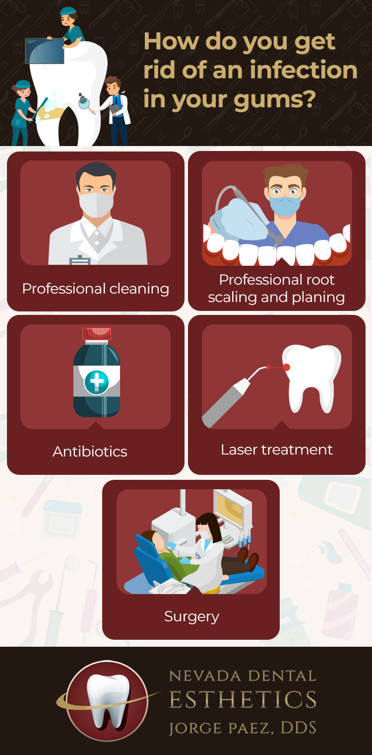 Infected Gums Treatments Las Vegas NV