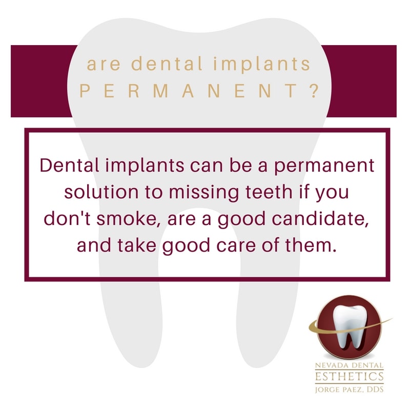 are dental implants permanent