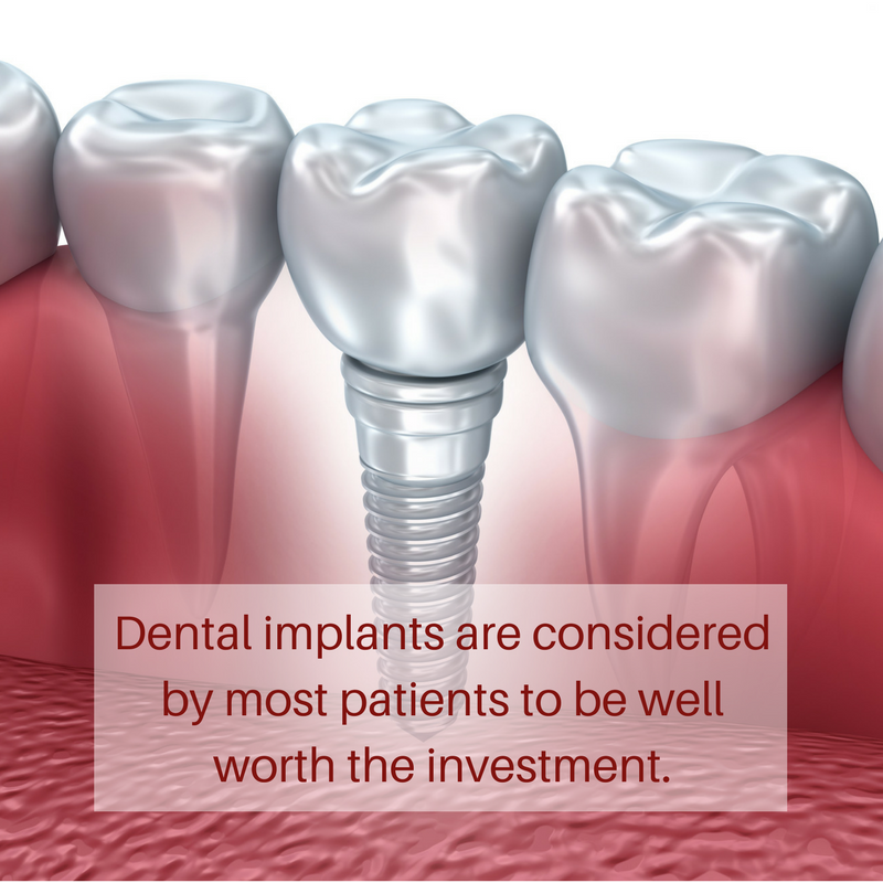 Are dental implants worth the cost in Las Vegas