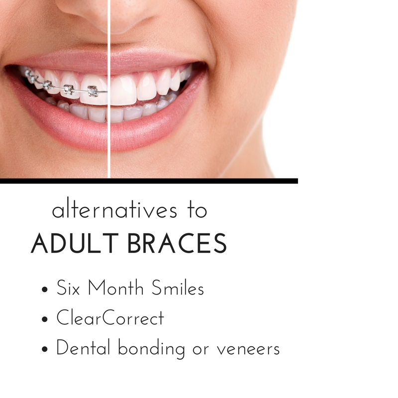 Clear Esthetic Adult Braces