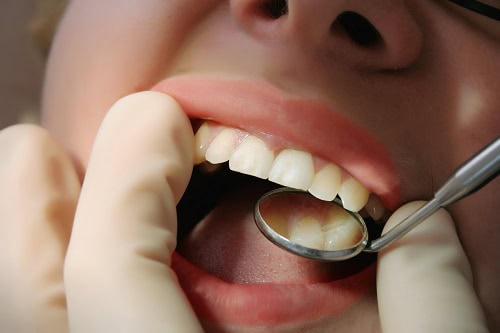 patient getting dental gum exam