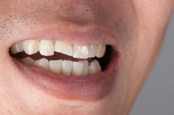 shutterstock 613110224 0 shutterstock 613110224 0