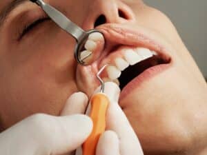 gum disease 