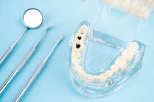 Healthy,And,Decayed,Teeth,Model,And,Mouth,Mirror,,Dental,Concepts.