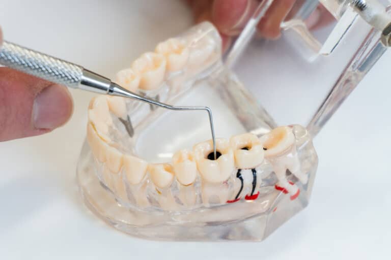 Plastic,Model,Of,A,Human,Jaw.,Dentist,Demonstrates,Problems,With