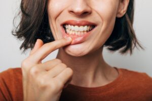 Close up of woman pointing to her teeth, experiencing tooth sensitivity after whitening treatment.