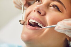 A close-up shot of a dentist examining a woman's teeth to place inlays and onlays