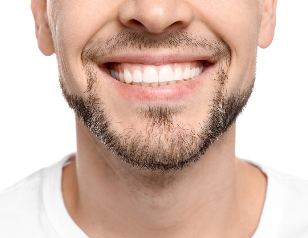 A close-up shot of a man's smile after getting dental crowns in Las Vegas