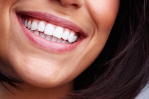 A close-up shot of a woman's smile after ZOOM! Teeth Whitening
